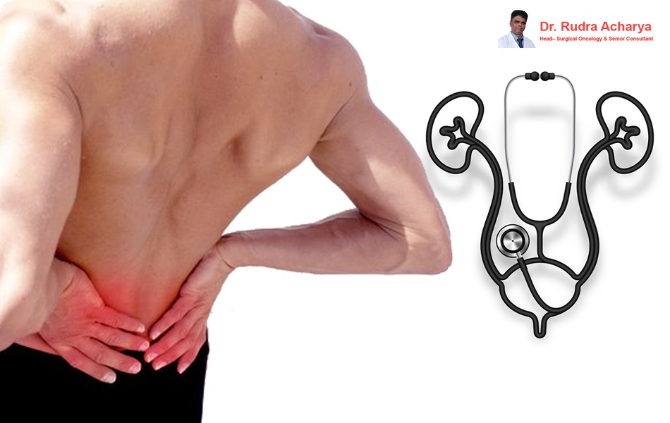 Best kidney Cancer Treatment in Your City