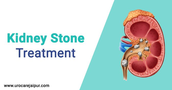 Dr. Lokesh Sharma - The Experienced Urologist in Jaipur.