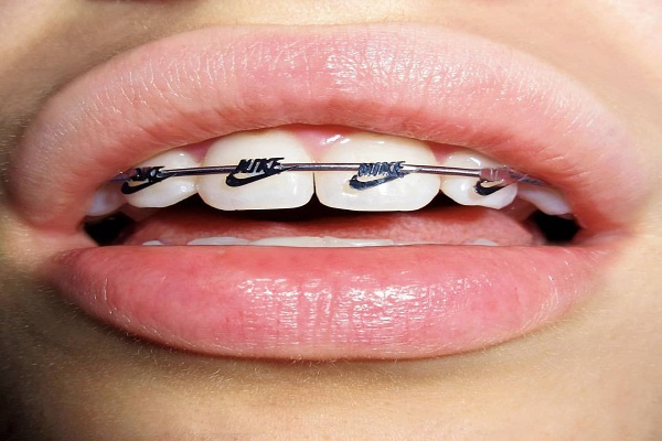 Pediatric Orthodontist Near Me