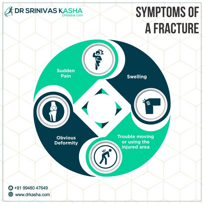 Bone Fracture Surgery Specialist | Fracture Surgeon in Hyderabad