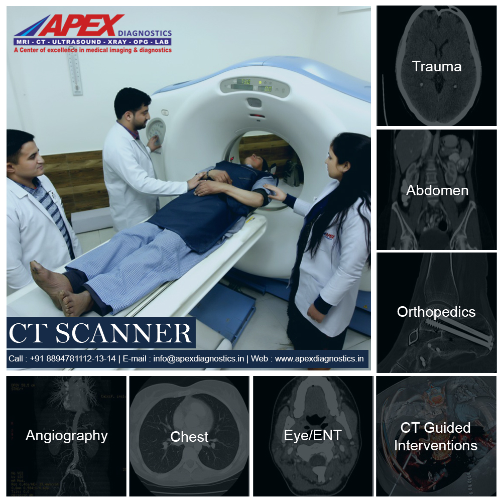 CT Scan services in Himachal
