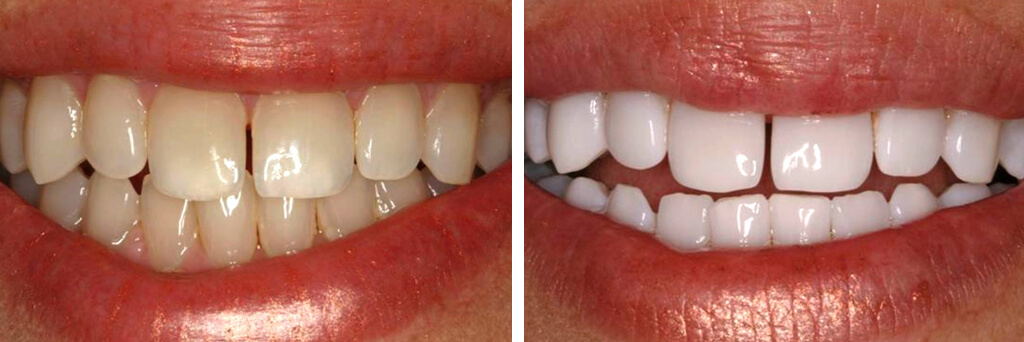 Best Childrens Dentist Near Me