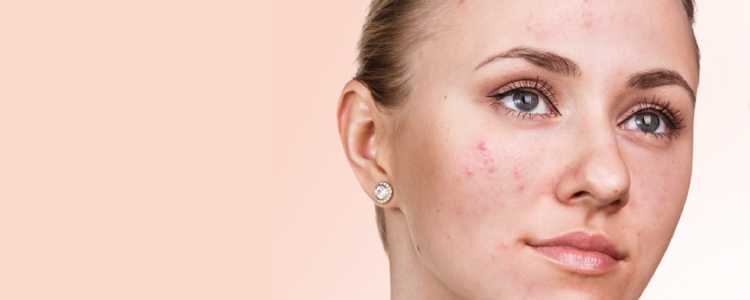 Skin Specialist in Chandigarh