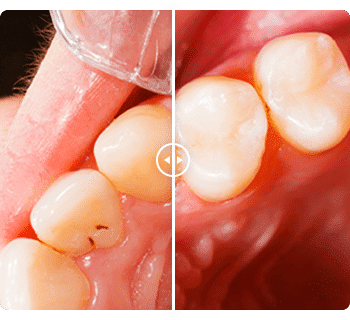 Call Us 7903265800 Best dental clinic and hospital in patna | best dental hospital in Patna 8