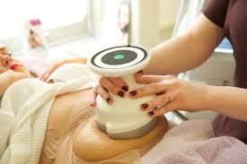 How Long Does Coolsculpting Last?