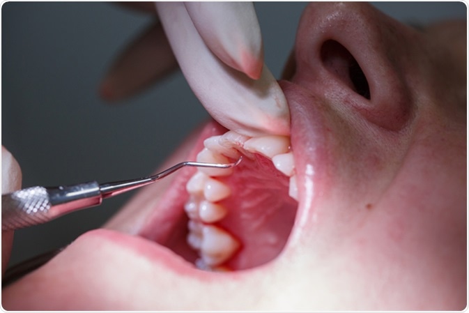 Root Canal Specialist - Houston, TX