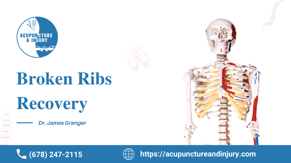 Best Guide for Broken ribs recovery