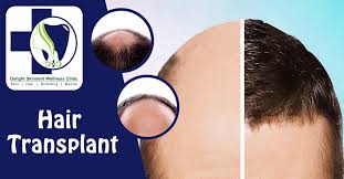 Skin and Hair Treatment in Jaipur
