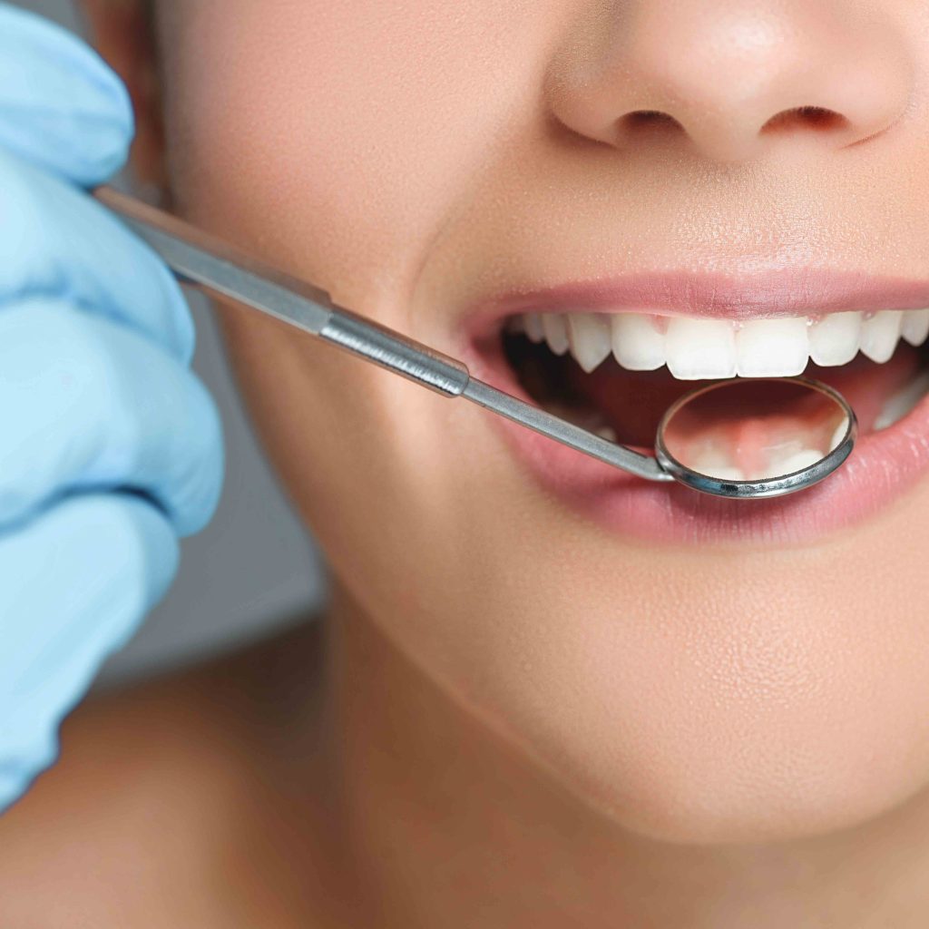 How Much Does a Tooth Filling Cost?