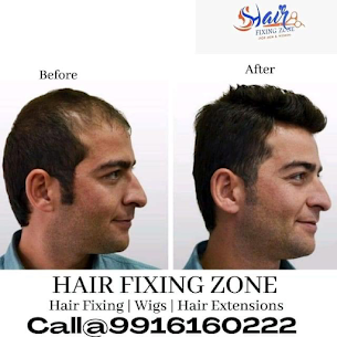 Best And Latest Hair Loss Treatment For Men