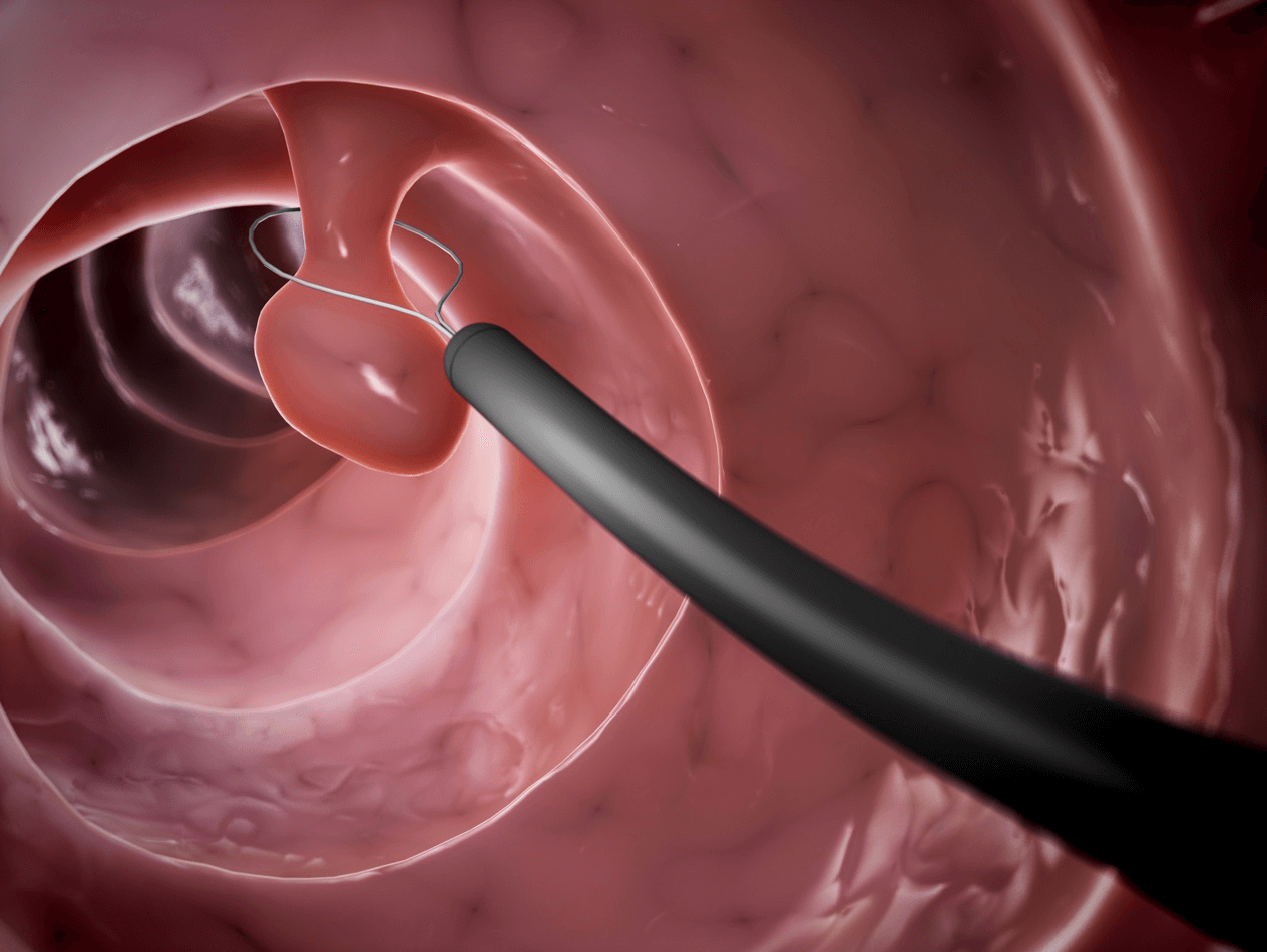 Endoscopy Specialist in London