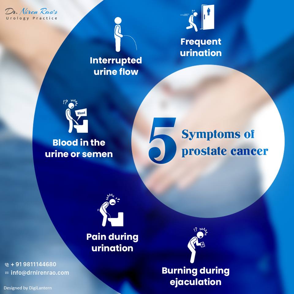 Prostate Cancer Treatment in Delhi