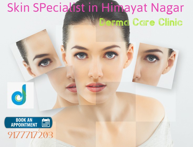 Skin Specialist in Himayat Nagar | Acne Scar Treatment in Himayat Nagar