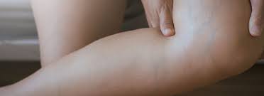 San Diego Vein Treatment Near Me