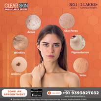 best advanced keloid & hypertrophic scar treatment in india