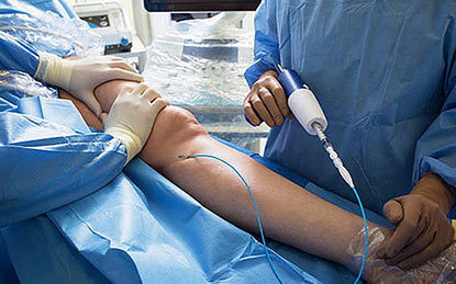 Top Rated Vein Clinic in NYC