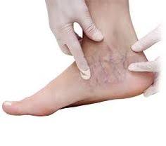 Why choose New Jersey Vein Center?
