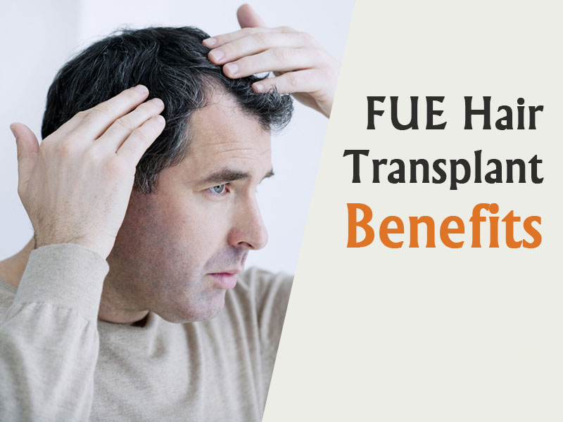 Best Beard Hair Transplant in Hyderabad | Kondapur