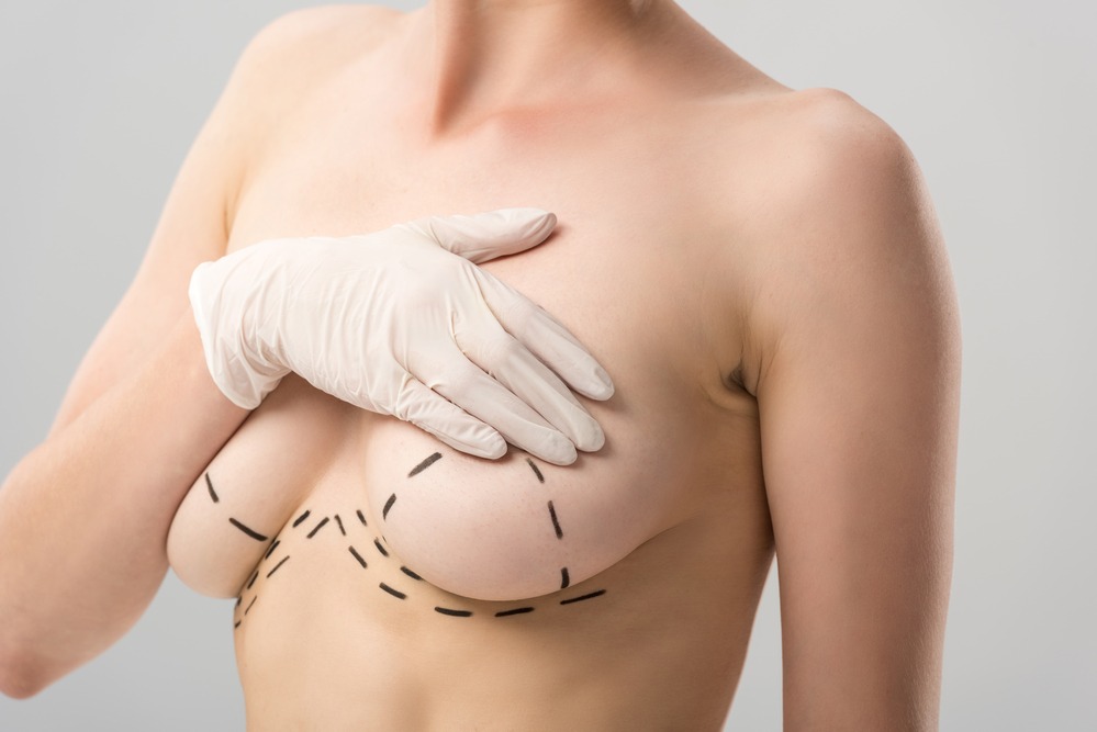 Breast Lift Surgery in Gurgaon