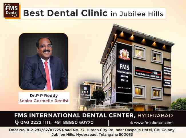 Leading Dental Clinic in Jubilee Hills | FMS International Dental Center - Advanced Dental Implant Clinic