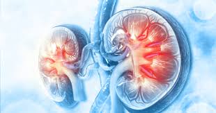 9801040490Best nephrologist in patna | Best nephrology in patnaDr. Vinod Kumar Singh ( EX. Prof. & Head nephrology PMCH ) | Splendid Kidney Hospital & Research Centre