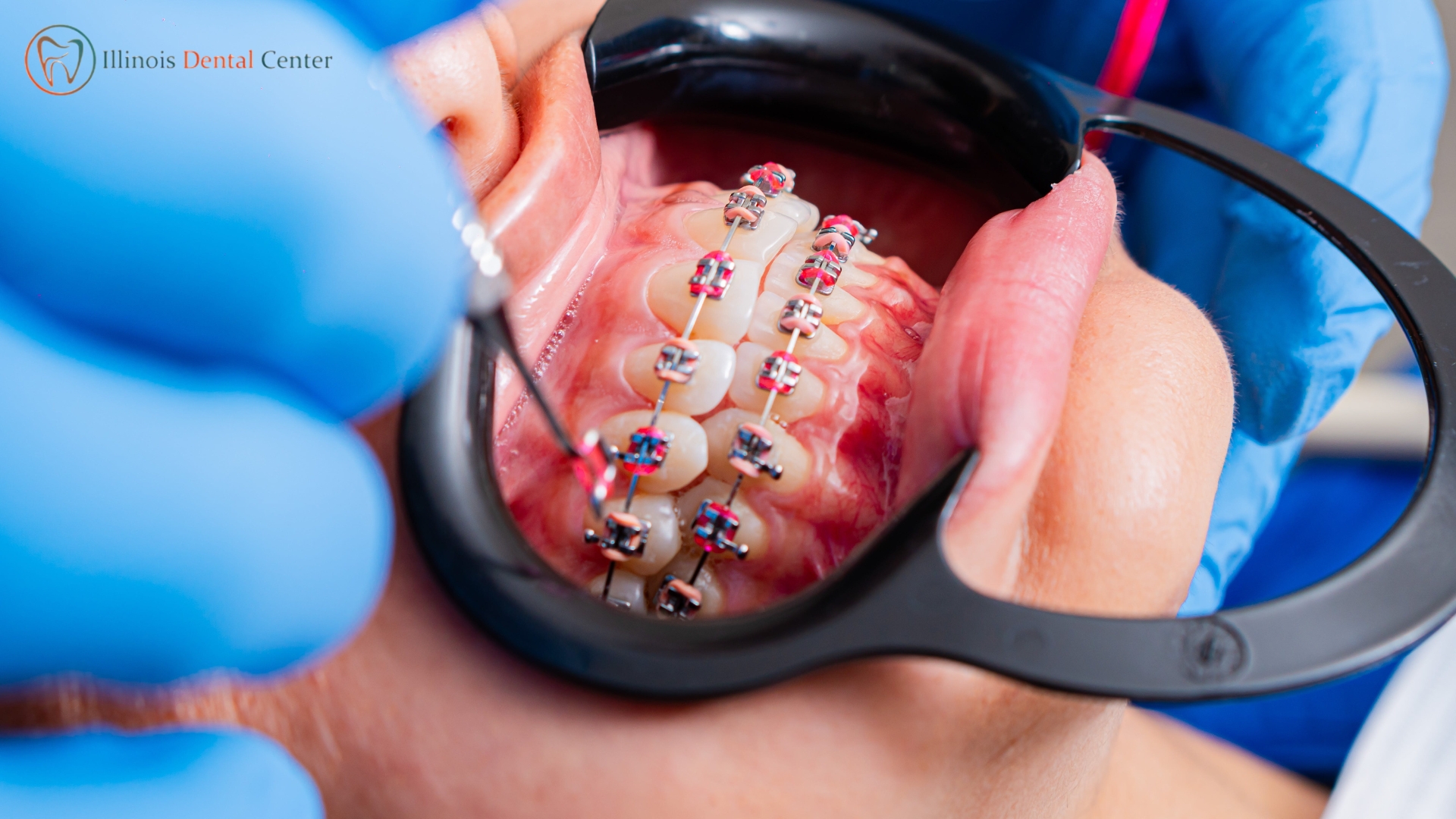 Searching for an experienced orthodontist in Wheeling, IL?