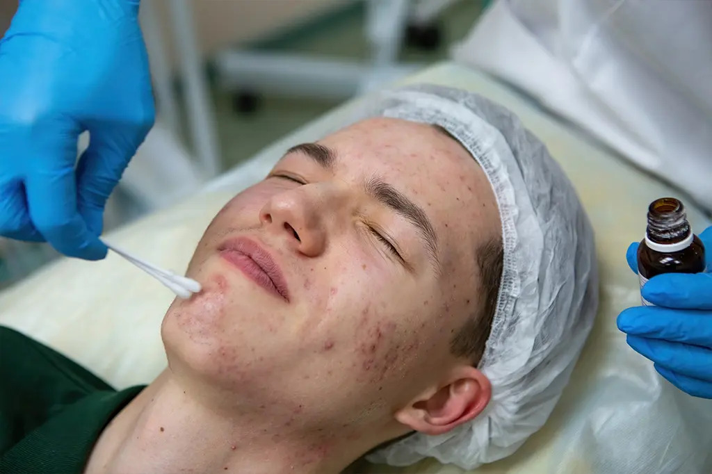 Expert Skin Pigmentation Treatment Services in Dubai