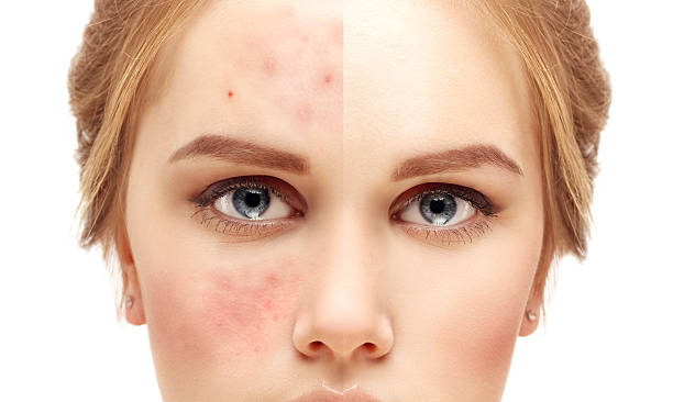 Best Skin Specialist in Karachi - Dermatologist Near Me
