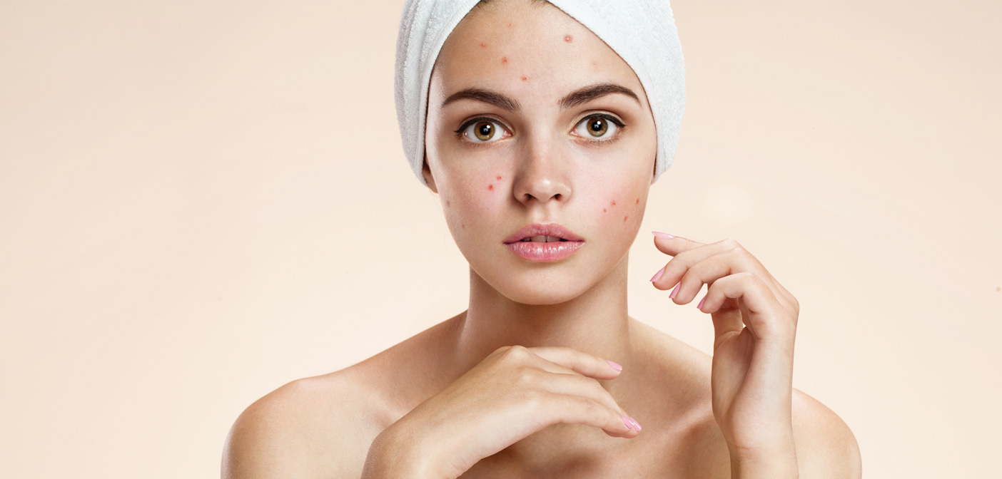 Treatments for Skin Diseases (Psoriasis Treatment)