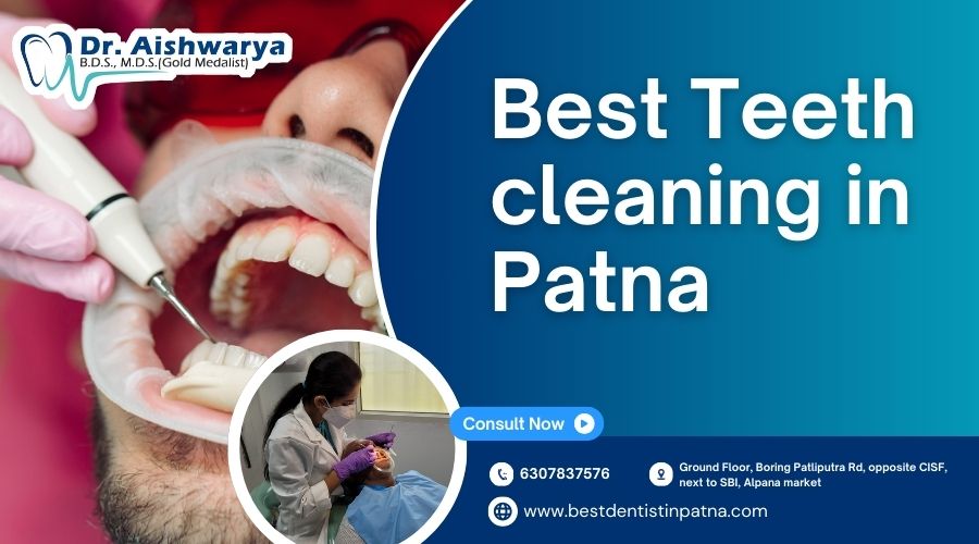 Best Teeth Cleaning in Patna - Dr. Aishwarya’s Multispeciality Dental Clinic
