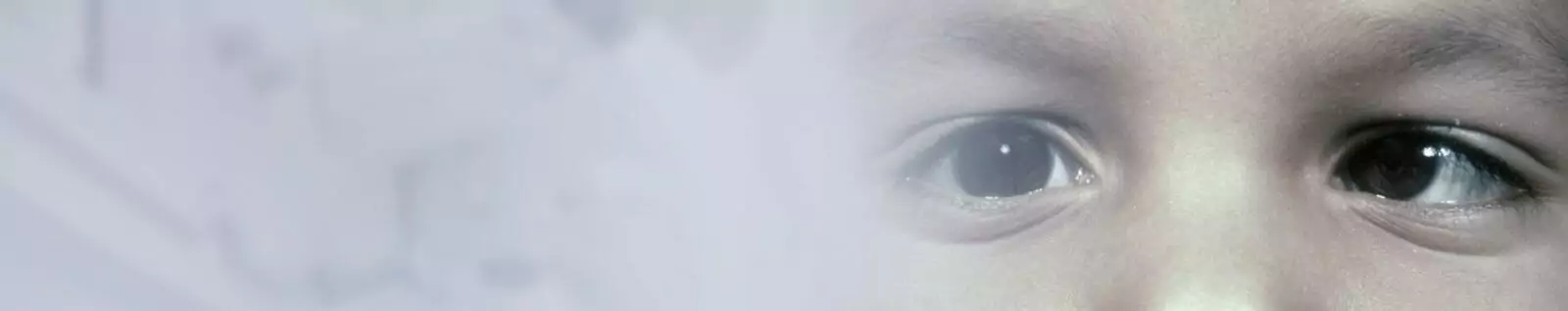 Eye Hospital In Bellandur