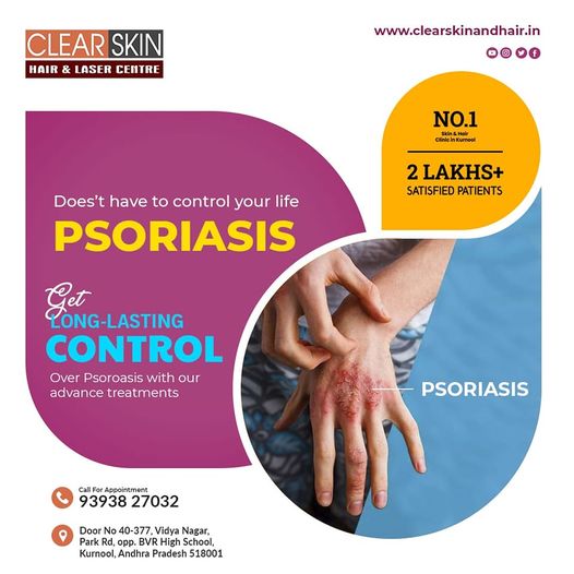 best dermatologist in Kurnool