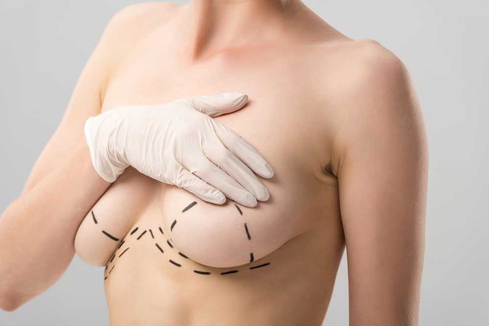 https://www.drpriyabansal.com/breast-lift/