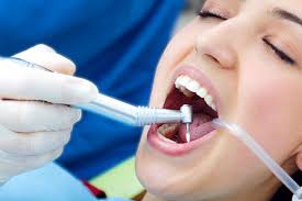 Best Cosmetic Dentistry Houston Tx