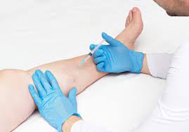 Houston Vein Treatment Center Near Me