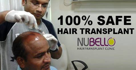 Are you covering your baldness?