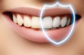 Laser Teeth Whitening Houston