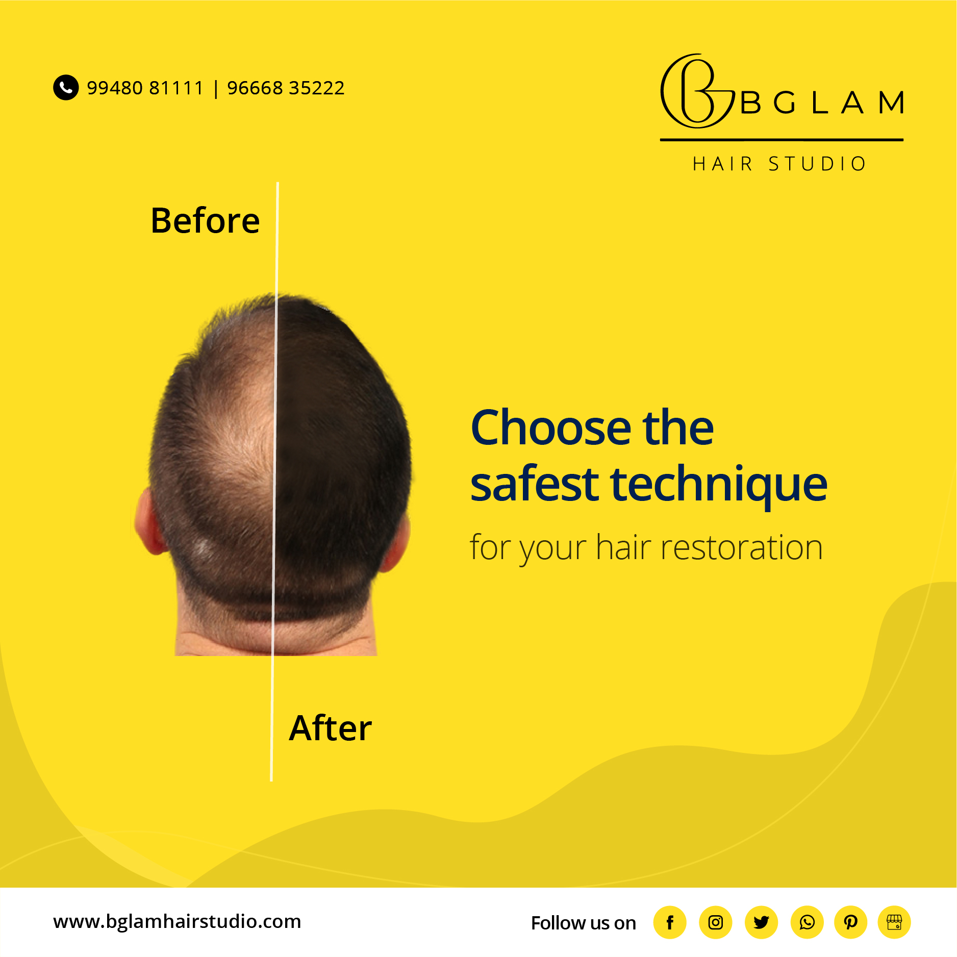 Hair Fixing Services Hyderabad