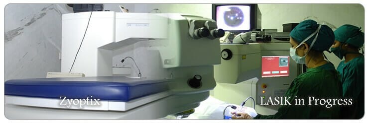 Lasik Eye Surgery