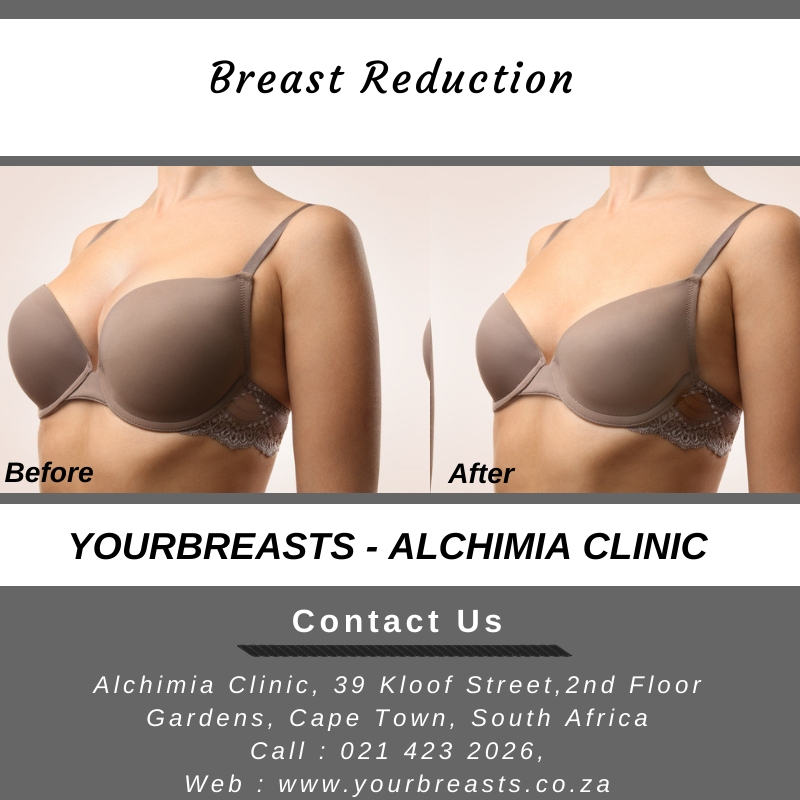 Best and affordable breast reduction surgery treatment in Cape Town
