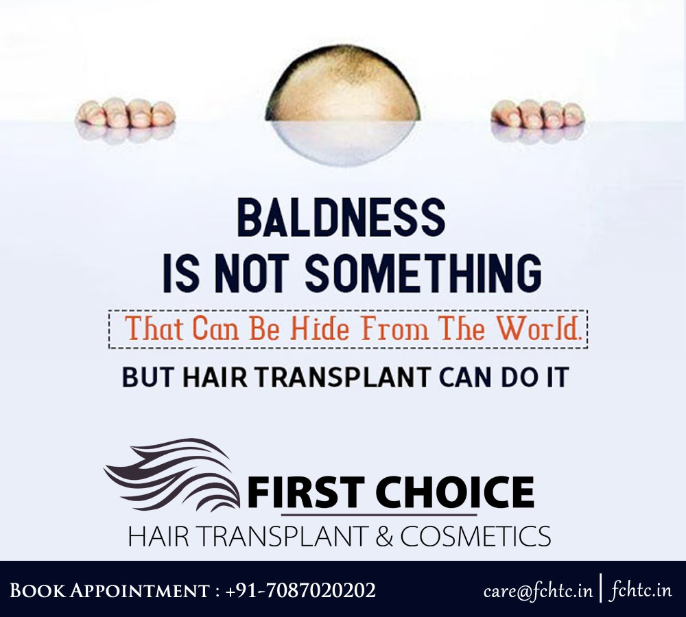 Hair Transplant In Ludhiana, Punjab - Cost, Clinic | Fchtc