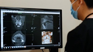 Dental Crowns Near Me
