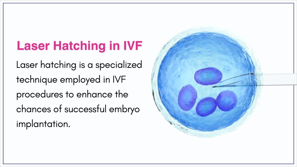 Laser Hatching in IVF – Gaudium IVF