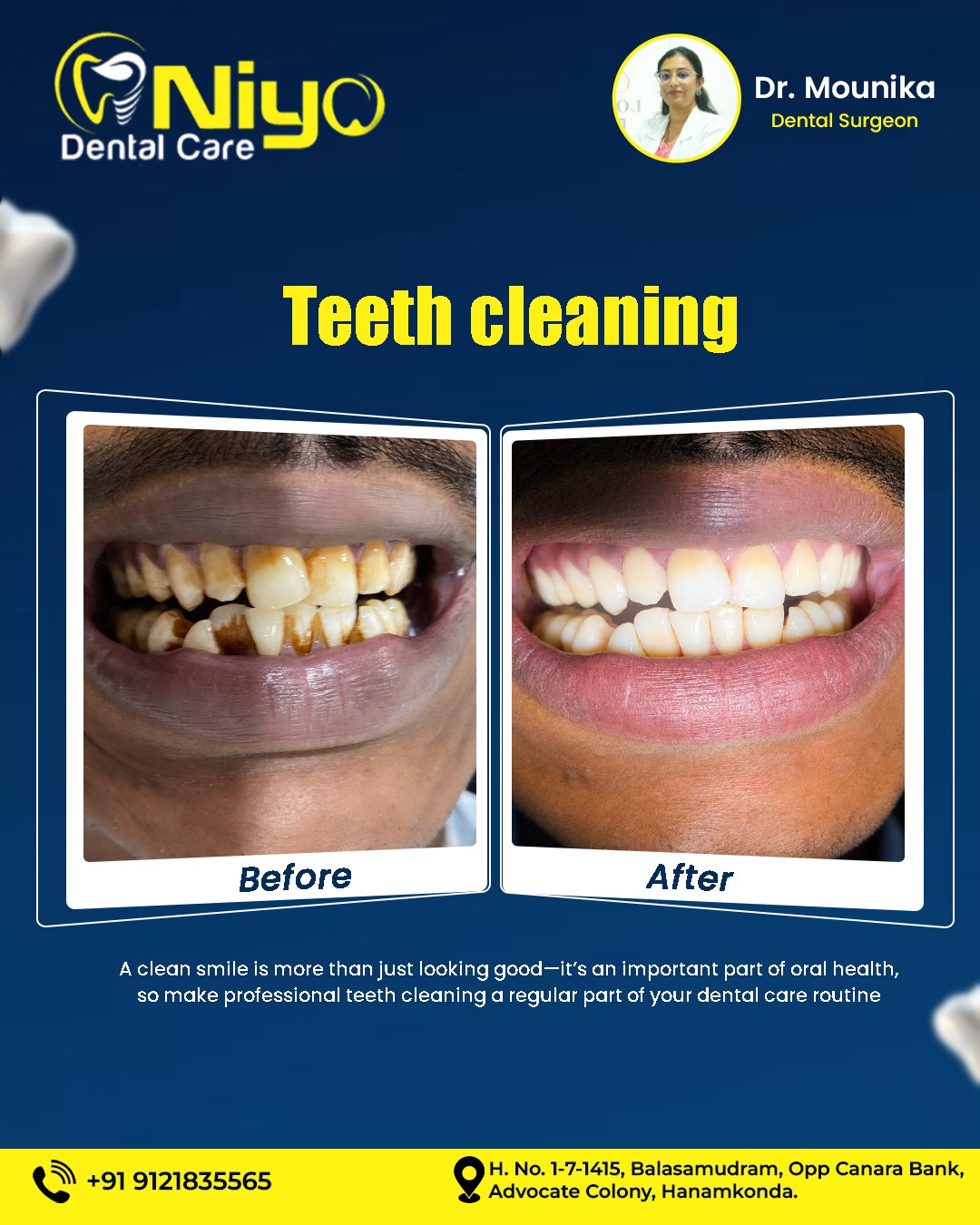 Best teeth cleaning in hanamkonda and warangal