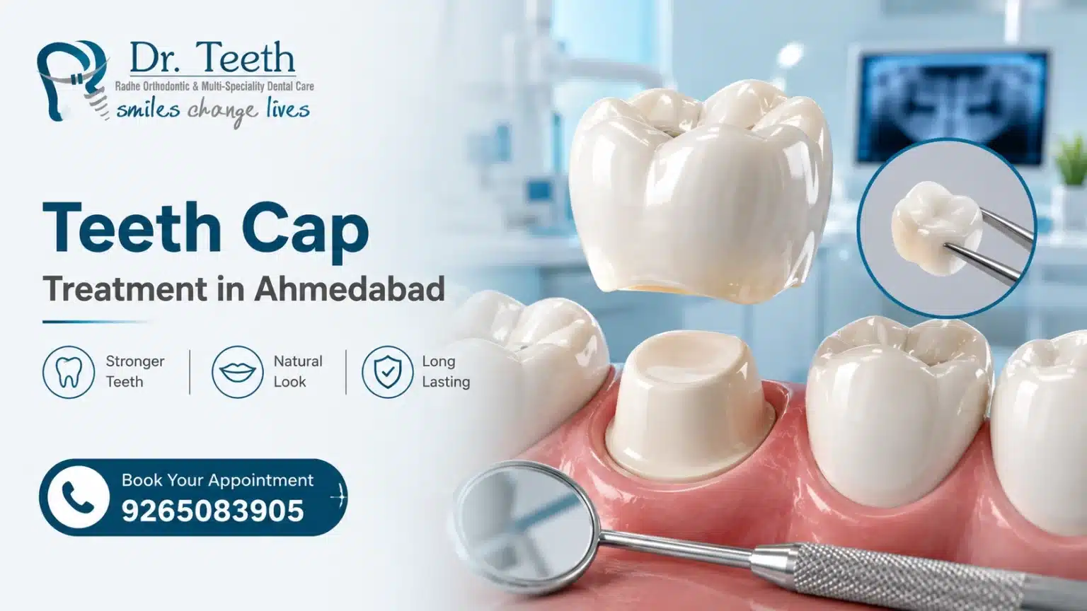 Teeth Cap Treatment in Ahmedabad