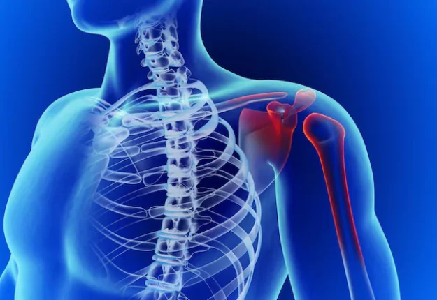 Advanced Treatment for Shoulder Dislocation
