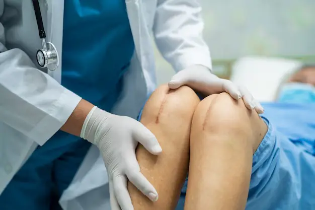 KNEE REPLACEMENT SURGERY