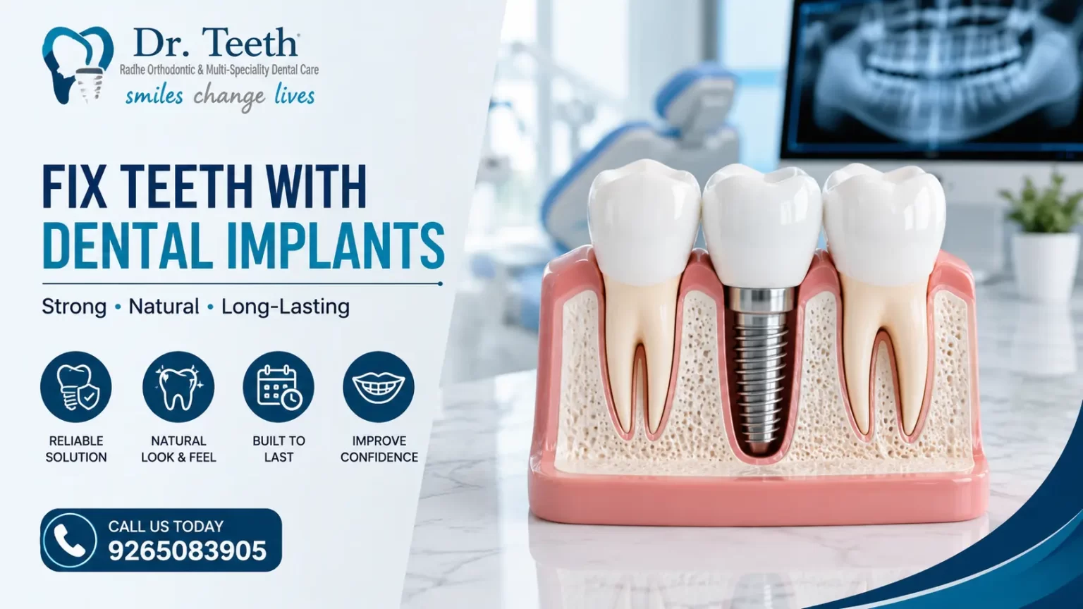 Fix Teeth With Dental Implants