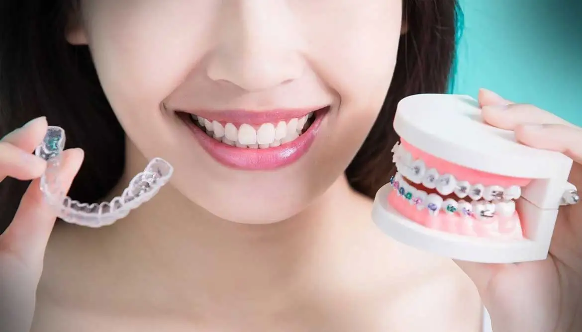 Invisible Braces Cost in Ahmedabad