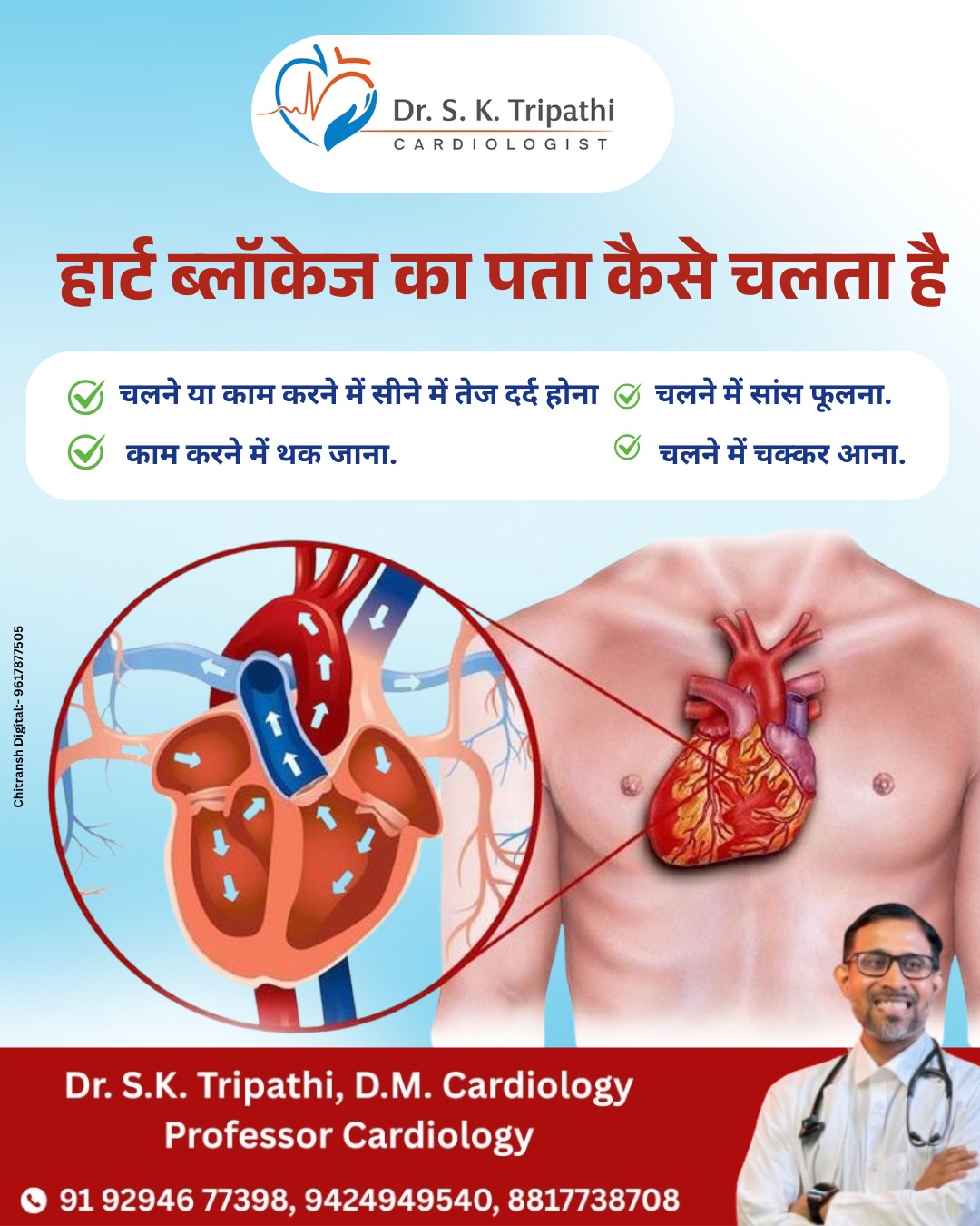Heart Blockage Treatment in Rewa